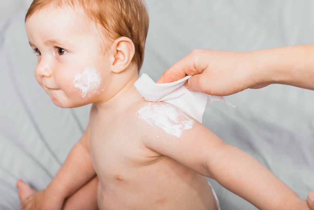 Common Baby Skincare Conditions and How to Treat Them