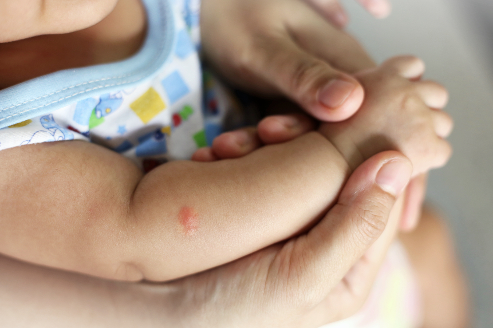 How to Treat Baby Dry Skin and Rashes: Best Baby Skin Care