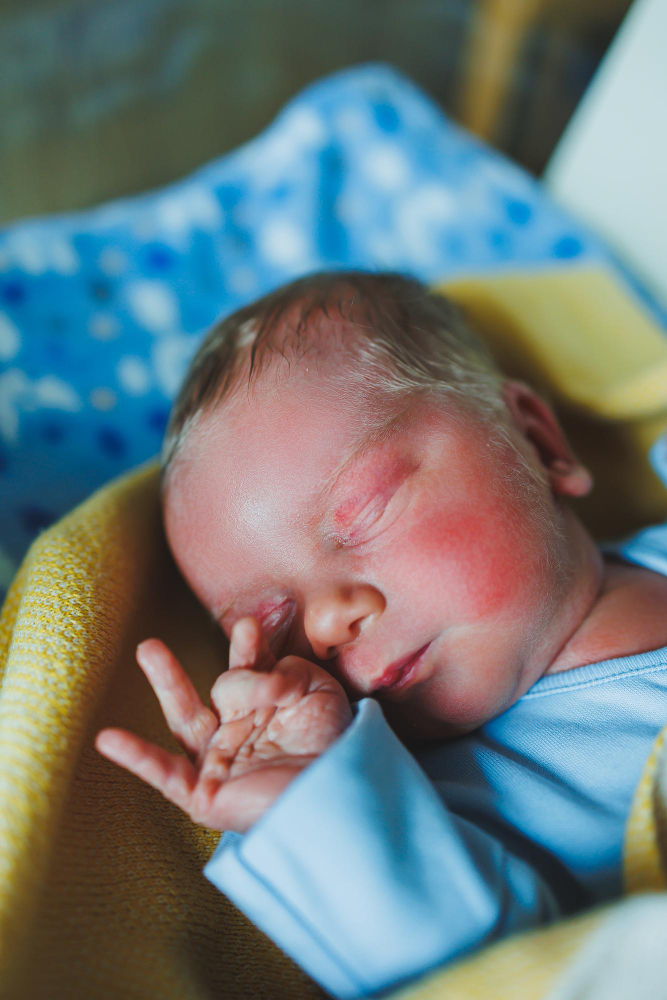 Newborn Jaundice Causes